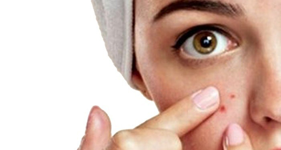 تعبیر خواب جوش زدن کف سر ، معنی دیدن جوش زدن کف سر در خواب ما چیست