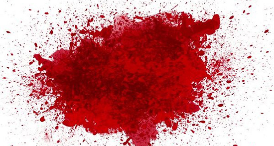 تعبیر خواب خون مردگی ، معنی دیدن خون مردگی در خواب های ما چیست