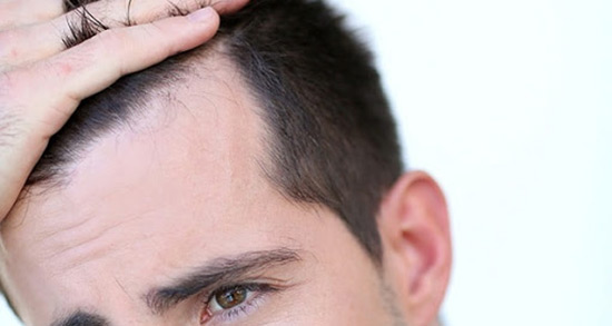 تعبیر خواب دیدن شپش ، معنی دیدن شپش در خواب های ما چیست