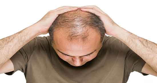 تعبیر خواب ریزش مو ، از امام صادق و حضرت یوسف و ریختن نصف موی سر دیگران