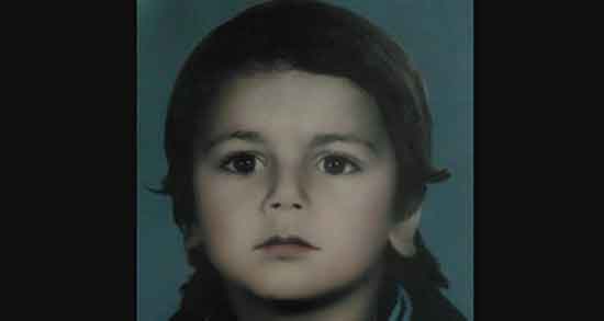 تعبیر خواب صورت ، زخمی و سوخته و کبودی صورت دیگران و پوست صورت