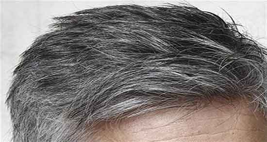 تعبیر خواب موی سر مرده ، ترشیدن و ریختن و سفید شدن موی سر مرده