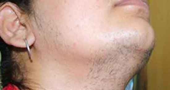 تعبیر خواب موی صورت زنان ، و موی زائد صورت زنان و رویش مو در کف پا