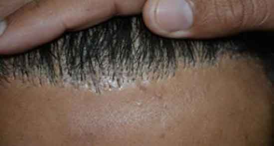 تعبیر خواب کنده شدن مو ، ابن سیرین و قطع شدن مو و ریختن نصف موهای سر