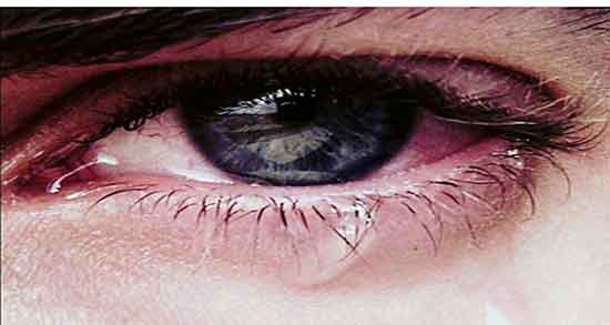 تعبیر خواب گریه وزاری ، برای مرده و جیغ زدن و اشک ریختن و در آغوش گرفتن