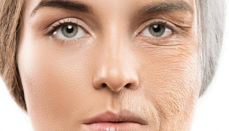 راهکارهای متنوع برای کاهش چین و چروک و خطوط ریز (لایه برداری، لیزر، تزریق و ...)