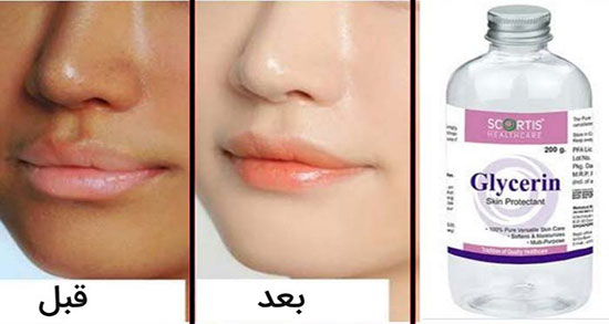 عوارض روغن گلیسیرین ؛ مضرات مصرف روغن گلیسیرین برای صورت