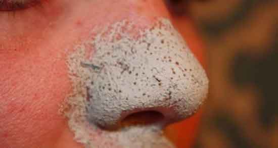 چوب صندل و رشد مو ؛ خاصیت مصرف چوب صندل برای تقویت موی سر چوب صندل و رشد مو ؛ خاصیت مصرف چوب صندل برای تقویت موی سر