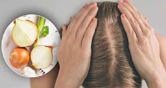 آب پیاز برای ریزش مو و فواید استفاده از آب پیاز برای درمان ریزش مو آب پیاز برای ریزش مو ؛ فواید استفاده از آب پیاز برای درمان ریزش مو