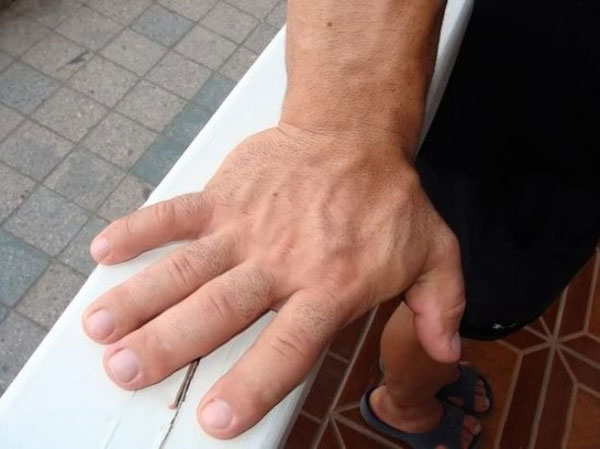 تعبیر خواب دست بزرگ + معنی دست بزرگ در خواب های ما چیست تعبیر خواب دست بزرگ + معنی دست بزرگ در خواب های ما چیست