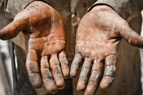 تعبیر خواب دست سیاه + معنی دست سیاه در خواب های ما چیست تعبیر خواب دست سیاه + معنی دست سیاه در خواب های ما چیست