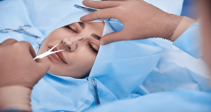 جراحی بینی بدون تامپون؛ دلایل عدم استفاده از تامپون و مراحل انجام عمل