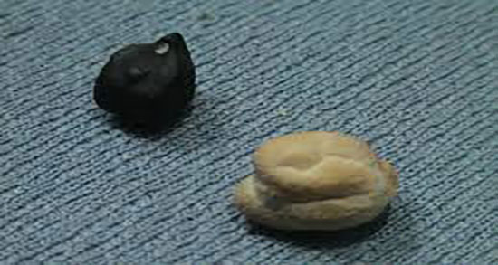 خواص نخود سیاه طب سنتی ؛ فواید مصرف نخود سیاه از نظر طب سنتی