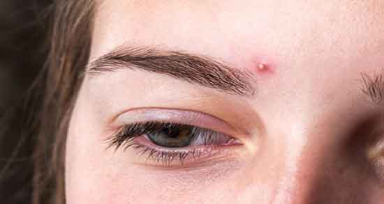 فواید کافور برای پوست ؛ شستشوی پوست صورت با استفاده از کافور