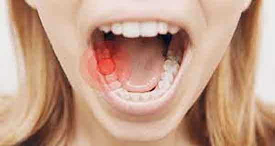 چقدر کافور بخوریم ؛ چه اندازه کافور در رابطه زناشویی میتوان مصرف کرد