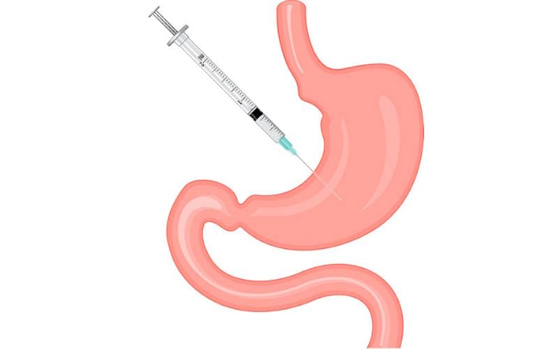 بوتاکس معده چیست؟ نحوه انجام و عوارض (مراقبت پس از بوتاکس) بوتاکس معده چیست؟ نحوه انجام و عوارض (مراقبت پس از بوتاکس)