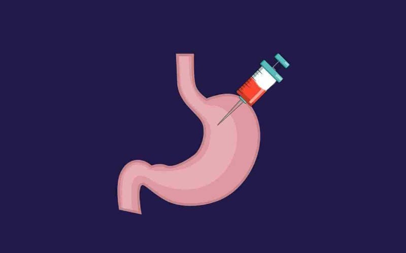 بوتاکس معده چیست؟ نحوه انجام و عوارض (مراقبت پس از بوتاکس) بوتاکس معده چیست؟ نحوه انجام و عوارض (مراقبت پس از بوتاکس)