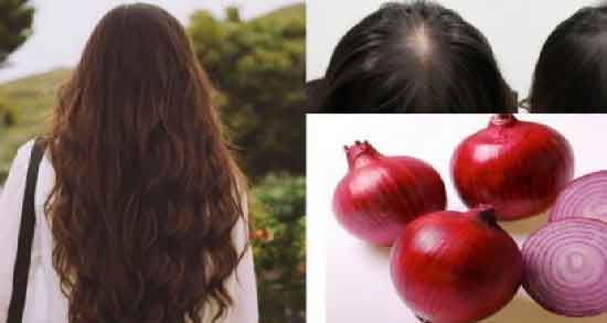 آب پیاز برای رشد مو و آشنایی با خواص آب پیاز برای افزایش رشد مو آب پیاز برای رشد مو ؛ آشنایی با خواص آب پیاز برای افزایش رشد مو