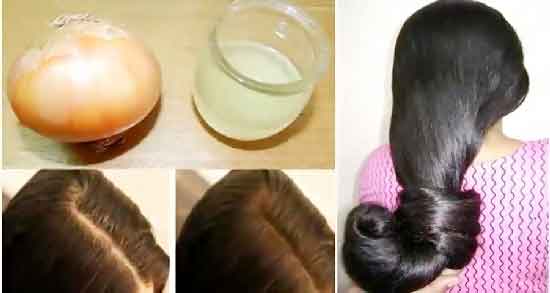 آب پیاز برای مو ؛ درمان ریزش و تقویت مو با آب پیاز