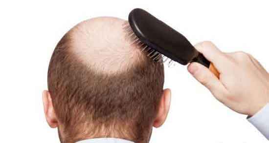 آب پیاز و موی سر و افزایش رشد مو با ماسک آب پیاز آب پیاز و موی سر ؛ افزایش رشد مو با ماسک آب پیاز