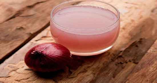 خواص آب پیاز برای مو و افزایش رشد مو با مصرف آب پیاز خواص آب پیاز برای مو ؛ افزایش رشد مو با مصرف آب پیاز