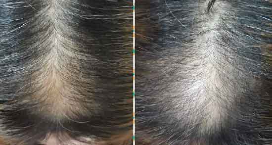 روغن حنا برای مو و جلوگیری از ریزش مو با روغن حنا روغن حنا برای مو ؛ جلوگیری از ریزش مو با روغن حنا