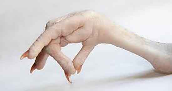 پای مرغ و فشار خون و ایا مصرف پای مرغ برای فشار خون مفید است پای مرغ و فشار خون ؛ ایا مصرف پای مرغ برای فشار خون مفید است