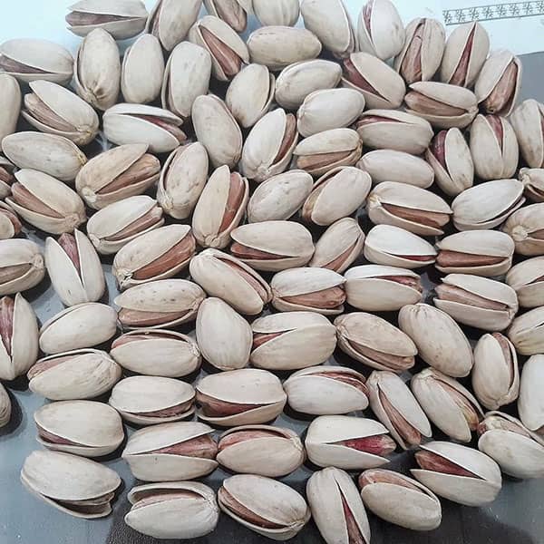 پسته برای کبد چرب ؛ خاصیت دارویی خوردن پسته برای درمان کبد چرب پسته برای کبد چرب ؛ خاصیت دارویی خوردن پسته برای درمان کبد چرب