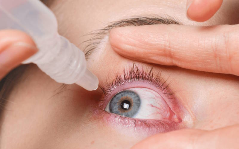 چشم درد و دلایل آن؛ روش های درمان درد چشم ها 2 روش های درمان درد چشم