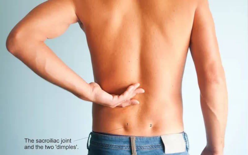 گودی کمر چیست؟ بررسی عوارض تا درمان و مشکلات گودی کمر چیست؟ بررسی عوارض تا درمان و مشکلات