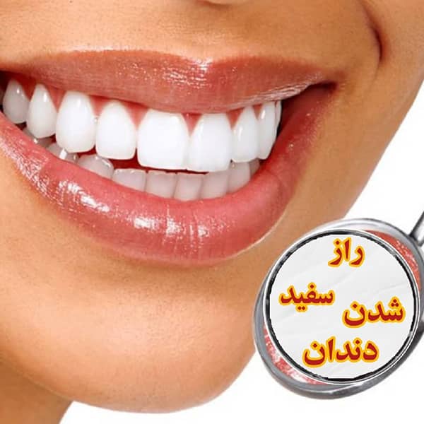 ۵ روش جالب برای سفید کردن دندان در دو دقیقه سفید کردن دندان در دو دقیقه