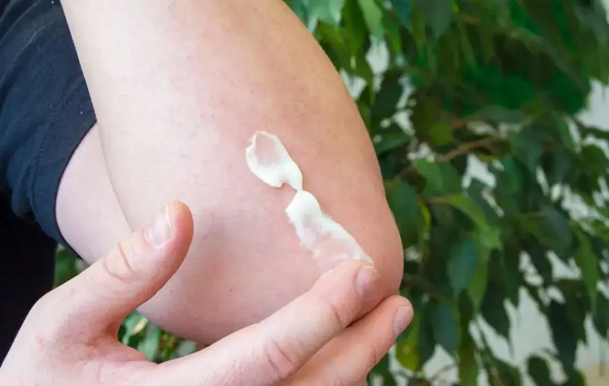 پماد بتامتازون برای چیست؟ موارد استفاده، عوارض و نحوه مصرف پماد بتامتازون برای چیست؟ موارد استفاده، عوارض و نحوه مصرف