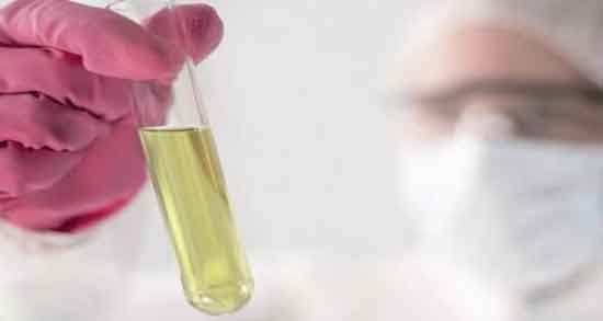 ادرار انسان در عطر و آیا برای ساخت عطرهای تقلبی از ادرار انسان استفاده می کنند؟ ادرار انسان در عطر ؛ آیا برای ساخت عطرهای تقلبی از ادرار انسان استفاده می کنند؟