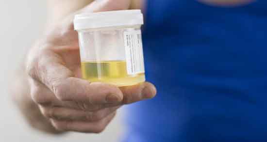 ادرار انسان چه خاصیتی دارد و همه چیز درباره خاصیت درمانی ادرار انسان ادرار انسان چه خاصیتی دارد ؛ همه چیز درباره خاصیت درمانی ادرار انسان