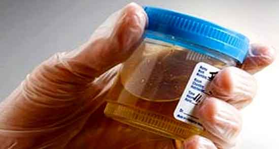 ادرار انسان چه فوایدی دارد و درمان عفونت ویروسی با ادرار انسان ادرار انسان چه فوایدی دارد ؛ درمان عفونت ویروسی با ادرار انسان