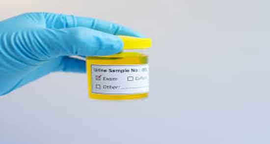 ادرار انسان چیست و اطلاعات کامل و حقایقی در مورد ادرار انسان ادرار انسان چیست ؛ اطلاعات کامل و حقایقی در مورد ادرار انسان