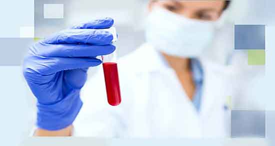 اسید فولیک در آزمایش خون و بالا بودن فولیک اسید در آزمایش خون اسید فولیک در آزمایش خون ؛ بالا بودن فولیک اسید در آزمایش خون