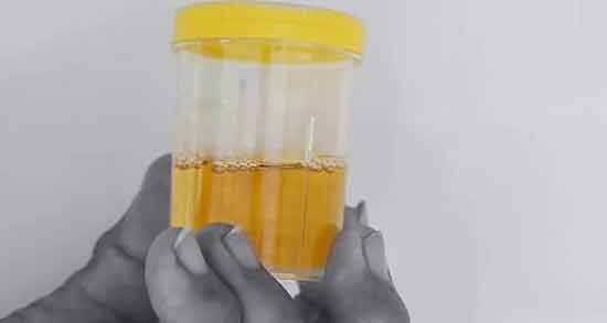 ترکیبات ادرار انسان و ترکیب شیمیایی ادرار انسان شامل چه موادی است ترکیبات ادرار انسان ؛ ترکیب شیمیایی ادرار انسان شامل چه موادی است