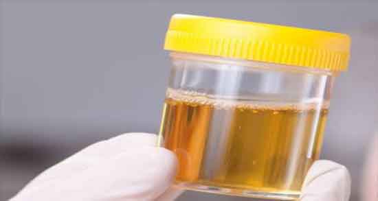 خاصیت ادرار انسان و اطلاعاتی کامل و جالب درباره خواص ادرار انسان خاصیت ادرار انسان ؛ اطلاعاتی کامل و جالب درباره خواص ادرار انسان