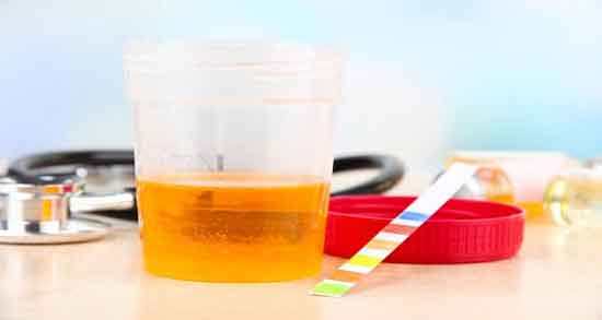 خواص ادرار انسان برای درخت و رشد بیشتر شاخ و برگ درختان با ادرار انسان خواص ادرار انسان برای درخت ؛ رشد بیشتر شاخ و برگ درختان با ادرار انسان