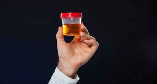 خواص ادرار شتر ماده و بررسی خواص درمانی استفاده از ادرار شتر ماده خواص ادرار شتر ماده ؛ بررسی خواص درمانی استفاده از ادرار شتر ماده