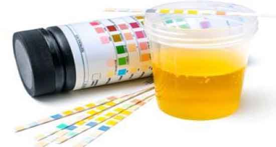 خواص درمانی ادرار انسان و همه چیز درباره خاضیت دارویی و درمانی ادرار انسان خواص درمانی ادرار انسان ؛ همه چیز درباره خاضیت دارویی و درمانی ادرار انسان