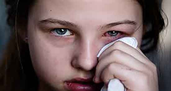 خواص هلیله سیاه برای چشم و فواید هلیله سیاه برای سیاهی دور چشم خواص هلیله سیاه برای چشم ؛ فواید هلیله سیاه برای سیاهی دور چشم