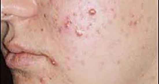 خواص ویتامین b12 برای پوست و مصرف قرص ویتامین b12 برای زیبایی خواص ویتامین b12 برای پوست ؛ مصرف قرص ویتامین b12 برای زیبایی