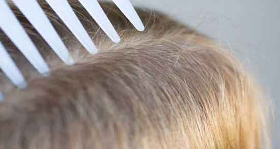 درمان شپش با اسپند ؛ درمان خانگی و فوری شپش با استفاده از اسپند درمان شپش با اسپند ؛ درمان خانگی و فوری شپش با استفاده از اسپند