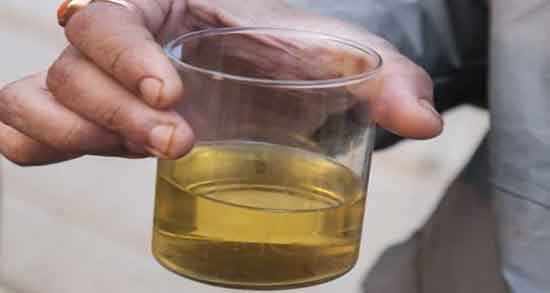 فواید ادرار انسان و آشنایی با خواص و فواید ادرار انسان برای سلامتی فواید ادرار انسان ؛ آشنایی با خواص و فواید ادرار انسان برای سلامتی