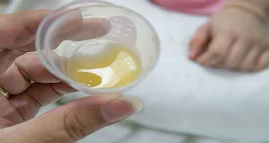 مضرات آغوز و عوارض مصرف آغوز گاو برای بزرگسالان و کودکان چیست مضرات آغوز ؛ عوارض مصرف آغوز گاو برای بزرگسالان و کودکان چیست