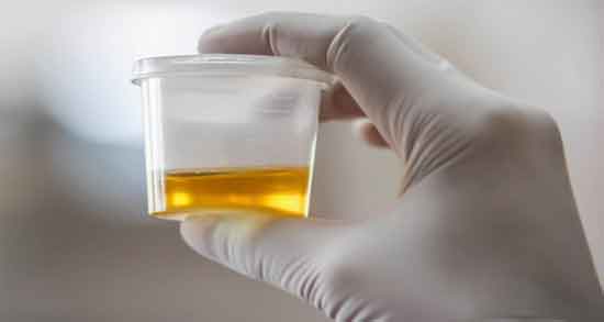 مضرات ادرار انسان و بررسی عوارض و مضرات ادرار انسان مضرات ادرار انسان ؛ بررسی عوارض و مضرات ادرار انسان