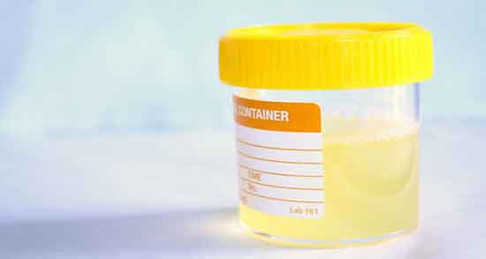 مواد تشکیل دهنده ادرار انسان و بررسی ترکیب شیمیایی ادرار انسان مواد تشکیل دهنده ادرار انسان ؛ بررسی ترکیب شیمیایی ادرار انسان