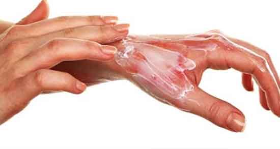 وازلین برای سوختگی و ایا وازلین برای سوختگی کشاله ران خوب است وازلین برای سوختگی ؛ ایا وازلین برای سوختگی کشاله ران خوب است